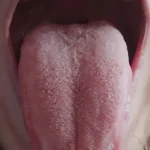 zinamix Clean-tongue-smoker