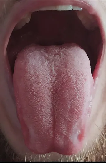 zinamix Clean-tongue-smoker